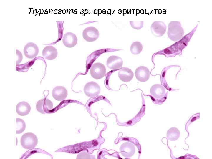 Trypanosoma sp. среди эритроцитов 