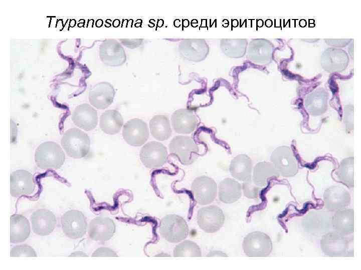 Trypanosoma sp. среди эритроцитов 