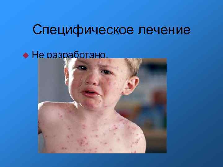 Специфическое лечение Не разработано. 