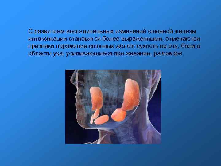 С развитием воспалительных изменений слюнной железы интоксикации становятся более выраженными, отмечаются признаки поражения слюнных