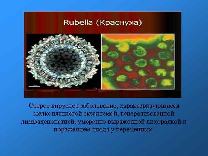 Острое вирусное заболевание, характеризующиеся мелкопятнистой экзантемой, генерализованной лимфаденопатией, умеренно выраженной лихорадкой и поражением плода
