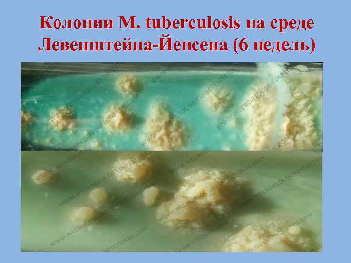 Колонии M. tuberculosis на среде Левенштейна-Йенсена (6 недель) 