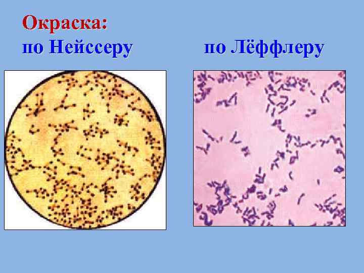 Окраска: по Нейссеру по Лёффлеру 