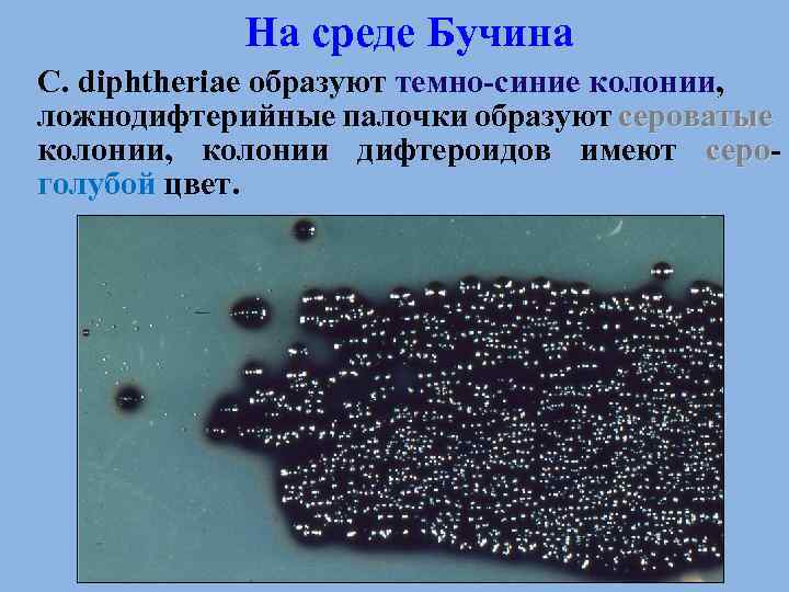 На среде Бучина C. diphtheriae образуют темно-синие колонии, ложнодифтерийные палочки образуют сероватые колонии, колонии