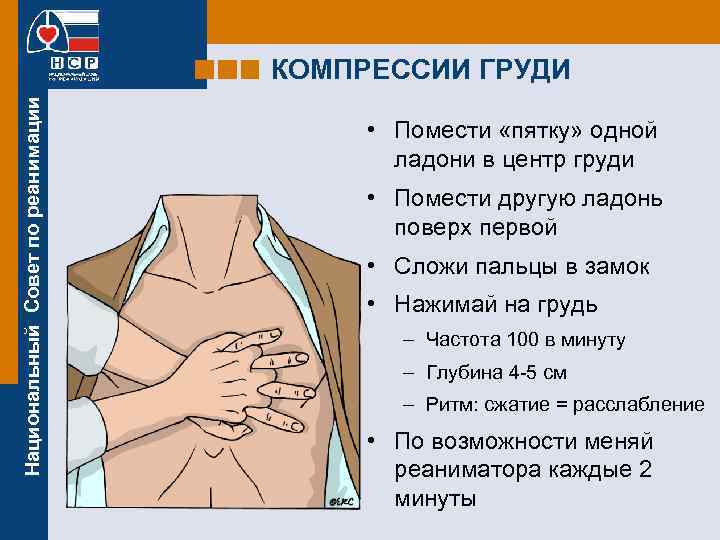 Национальный Совет по реанимации КОМПРЕССИИ ГРУДИ • Помести «пятку» одной ладони в центр груди