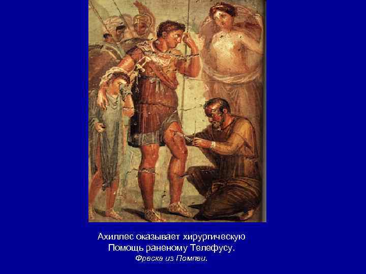 Ахиллес оказывает хирургическую Помощь раненому Телефусу. Фреска из Помпеи. 