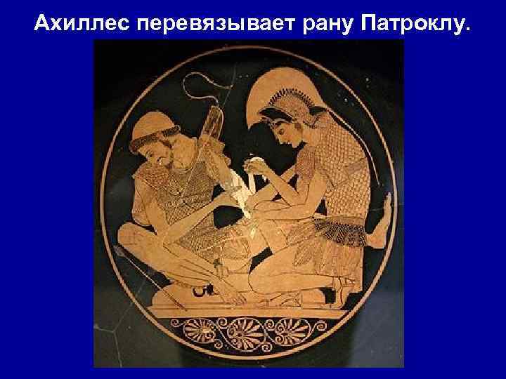 Ахиллес перевязывает рану Патроклу. 