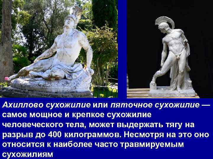 Ахиллово сухожилие или пяточное сухожилие — самое мощное и крепкое сухожилие человеческого тела, может