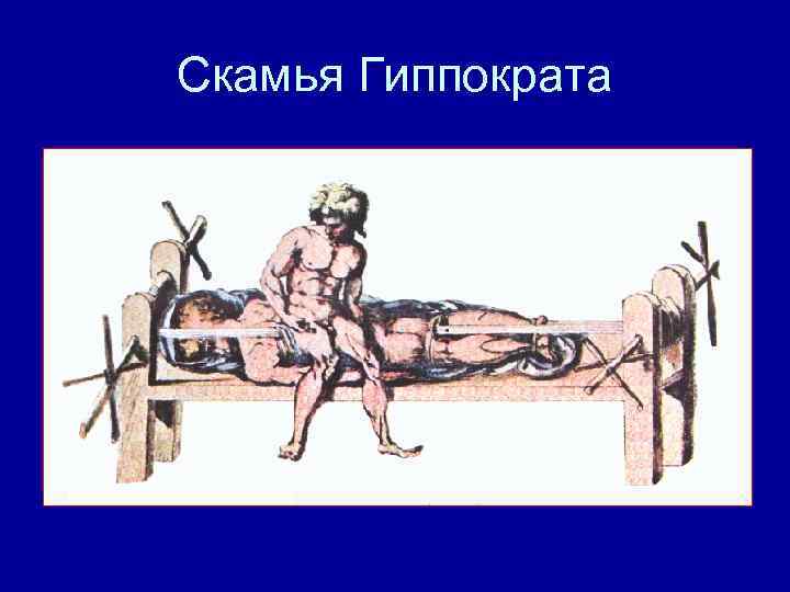 Скамья Гиппократа 