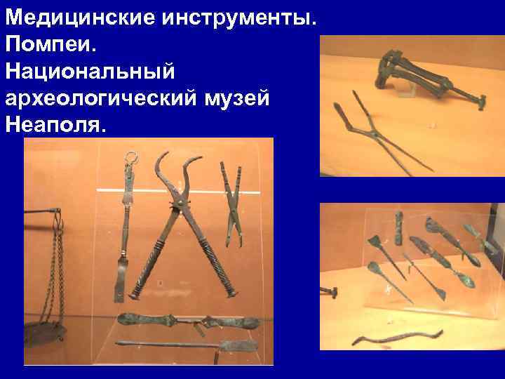 Медицинские инструменты. Помпеи. Национальный археологический музей Неаполя. 