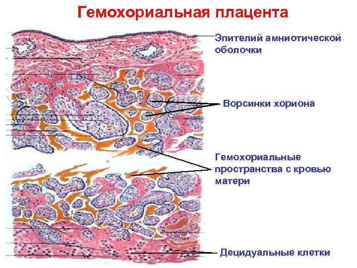 Гемохориальная плацента Эпителий амниотической оболочки Ворсинки хориона Гемохориальные пространства с кровью матери Децидуальные клетки