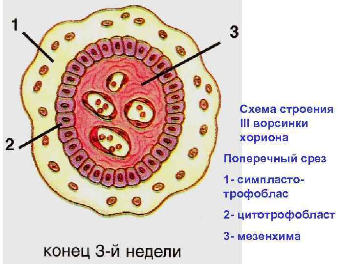 Ворсинки хориона фото