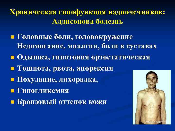 Хроническая гипофункция надпочечников: Аддисонова болезнь n n n Головные боли, головокружение Недомогание, миалгии, боли