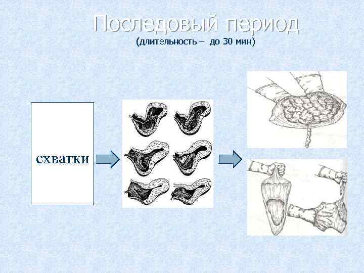 Последовый период (длительность – до 30 мин) схватки 