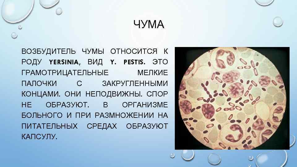 ЧУМА ВОЗБУДИТЕЛЬ ЧУМЫ ОТНОСИТСЯ К РОДУ YERSINIA, ВИД Y. PESTIS. ЭТО ГРАМОТРИЦАТЕЛЬНЫЕ МЕЛКИЕ ПАЛОЧКИ