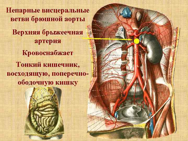 Непарные висцеральные ветви брюшной аорты Верхняя брыжеечная артерия Кровоснабжает Тонкий кишечник, восходящую, поперечноободочную кишку