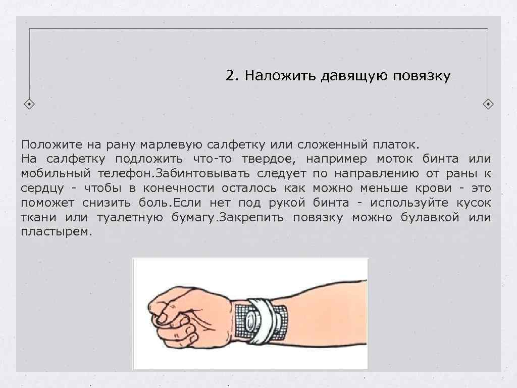 2. Наложить давящую повязку Положите на рану марлевую салфетку или сложенный платок. На салфетку