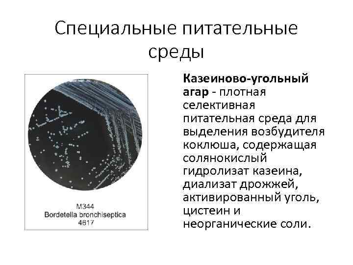 Специальные питательные среды Казеиново-угольный агар плотная селективная питательная среда для выделения возбудителя коклюша, содержащая