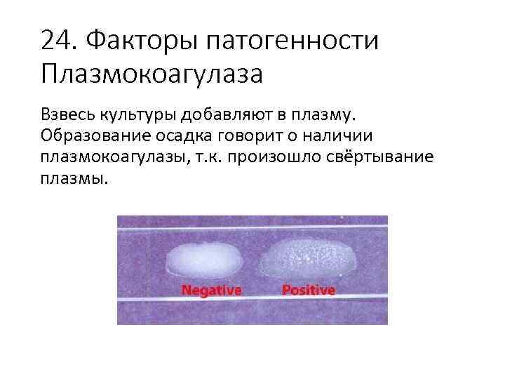 24. Факторы патогенности Плазмокоагулаза Взвесь культуры добавляют в плазму. Образование осадка говорит о наличии