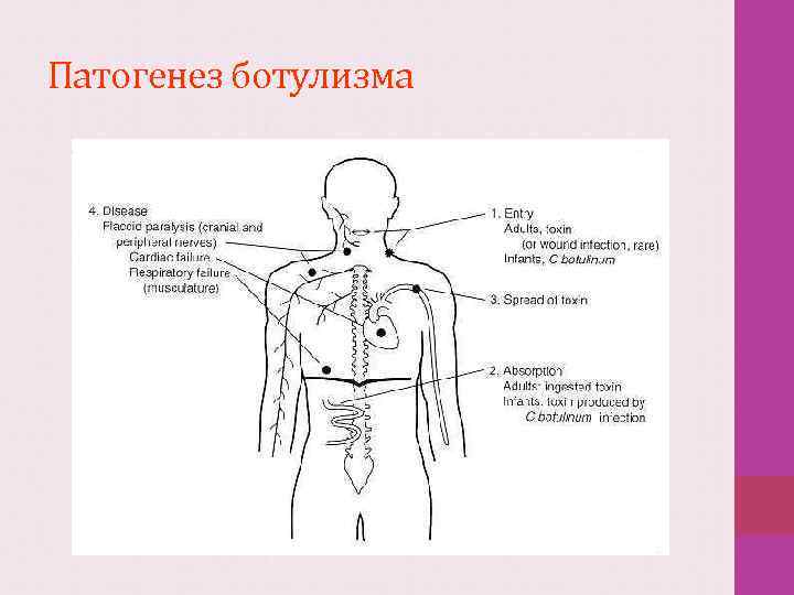 Патогенез ботулизма 