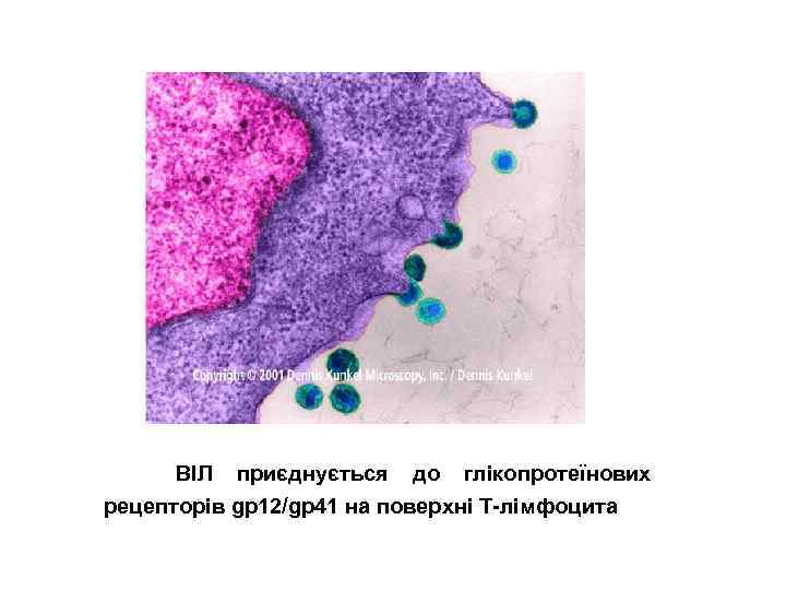  ВІЛ приєднується до глікопротеїнових рецепторів gp 12/gp 41 на поверхні Т-лімфоцита 