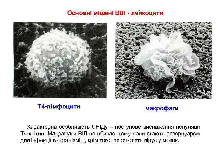 Основні мішені ВІЛ - лейкоцити Т 4 -лімфоцити макрофаги Характерна особливість СНІДу – поступове