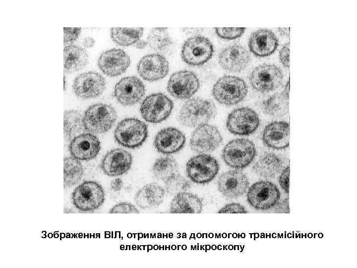 Зображення ВІЛ, отримане за допомогою трансмісійного електронного мікроскопу 
