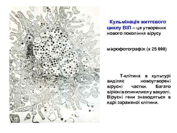  Кульмінація життєвого циклу ВІЛ – це утворення нового покоління вірусу мікрофотографія (х 25