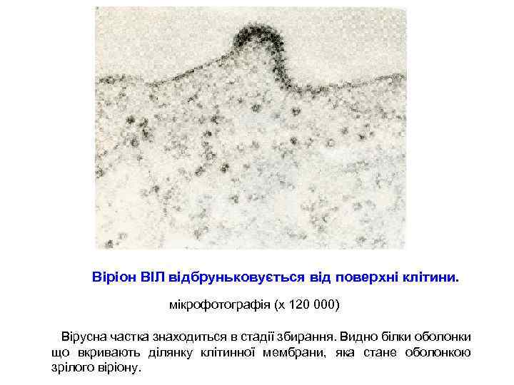 Віріон ВІЛ відбруньковується від поверхні клітини. мікрофотографія (х 120 000) Вірусна частка знаходиться в