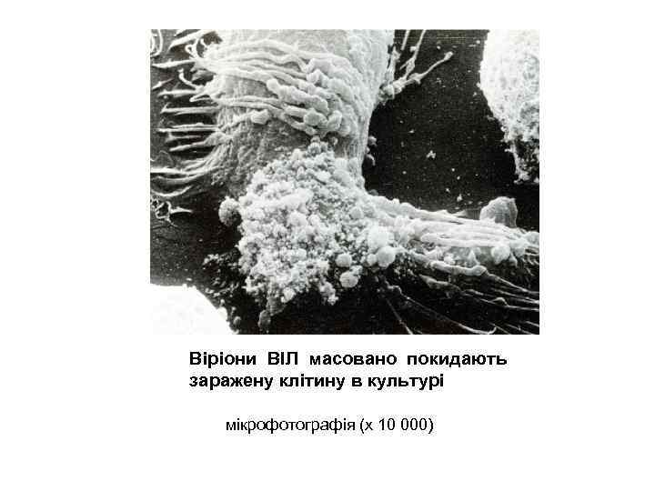 Віріони ВІЛ масовано покидають заражену клітину в культурі мікрофотографія (х 10 000) 