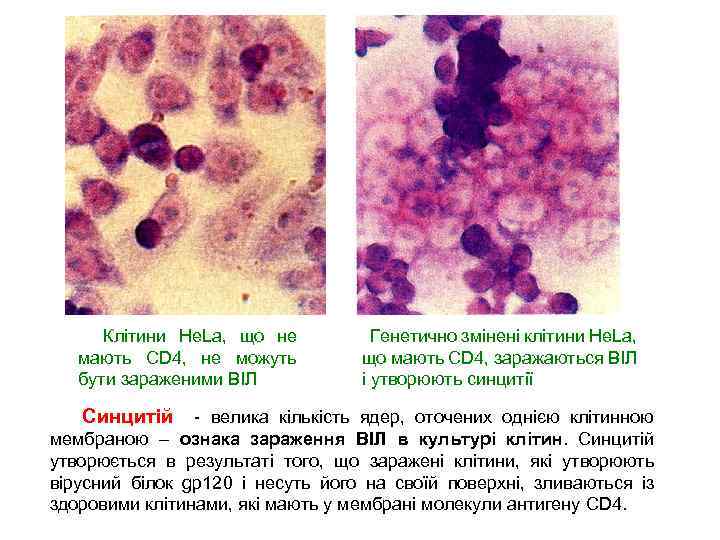  Клітини He. La, що не мають CD 4, не можуть бути зараженими ВІЛ