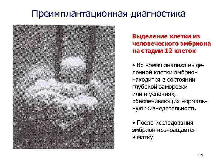 Выделение клетки. Психоаналитический подход эмбрион. Информационная ёмкость человеческой яйцеклетки.