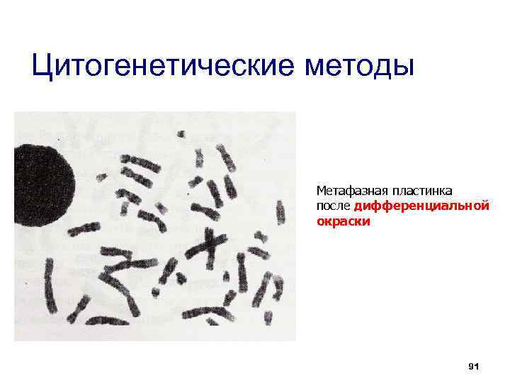 Метафазная пластинка. Метафазная пластинка после дифференциальной окраски. Метафазная пластинка под микроскопом. Метафазная пластинка человека под микроскопом. Метафазная пластинка болезни.