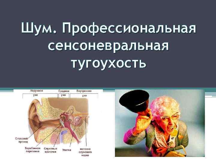 Сенсоневральная тугоухость. Профессиональная сенсоневральная тугоухость. Тугоухость профессиональное заболевание. Профзаболевание тугоухость. Профзаболевание сенсоневральная тугоухость.