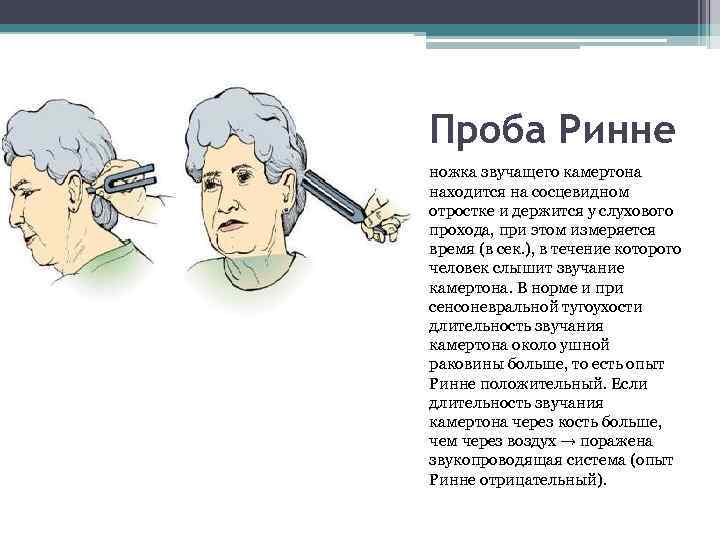 Исследование камертоном. Проба Вебера Ринне Швабаха. Камертональное исследование слуха. Проба Ринне при нейросенсорной тугоухости. Камертональное исследование слуха Швабаха.