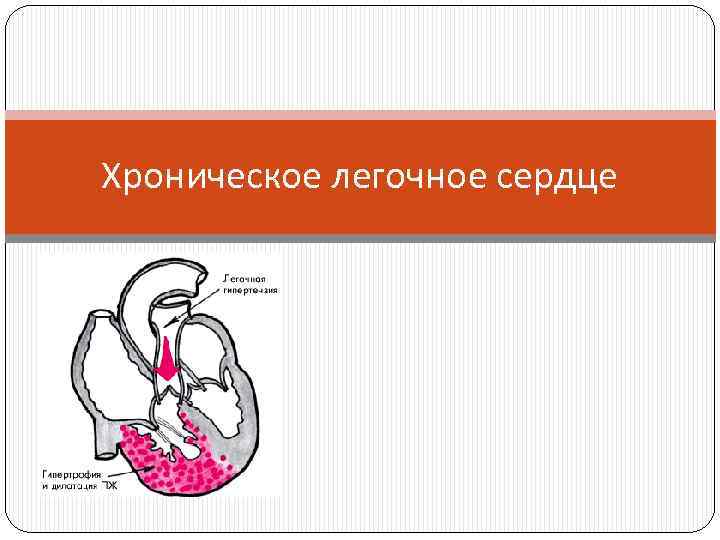 Хроническое легочное сердце. Подострое легочное сердце. Легочное сердце презентация. Хроническое легочное сердце презентация.