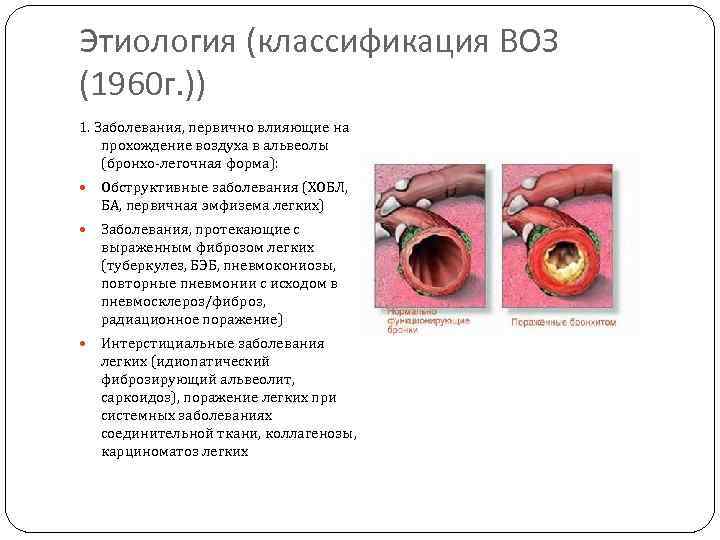 Этиология (классификация ВОЗ (1960 г. )) 1. Заболевания, первично влияющие на прохождение воздуха в