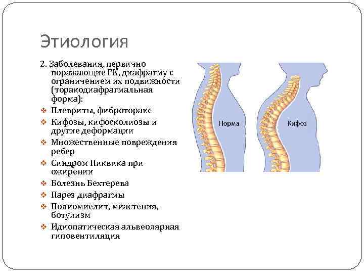 Этиология 2. Заболевания, первично поражающие ГК, диафрагму с ограничением их подвижности (торакодиафрагмальная форма): v