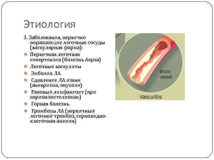 Хроническое легочное сердце Определение Это комплекс нарушений