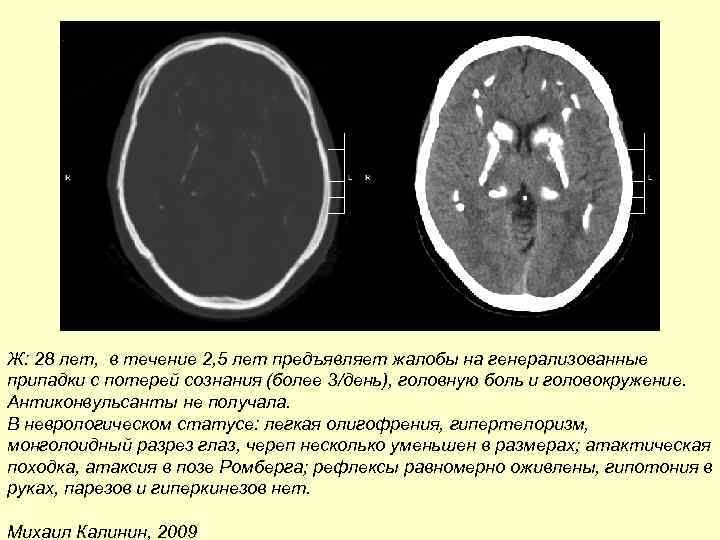 Болезнь фара это