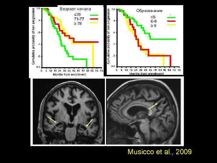 Возраст начала Образование Musicco et al. , 2009 