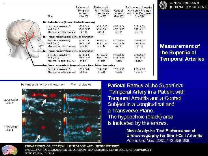 Measurement of the Superficial Temporal Arteries Parietal Ramus of the Superficial Temporal Artery in