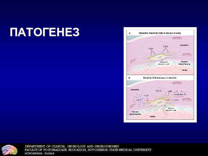 ПАТОГЕНЕЗ DEPARTMENT OF CLINICAL NEUROLOGY AND NEUROSURGERY FACULTY OF POSTGRADUATE EDUCATION, NOVOSIBIRSK STATE MEDICAL