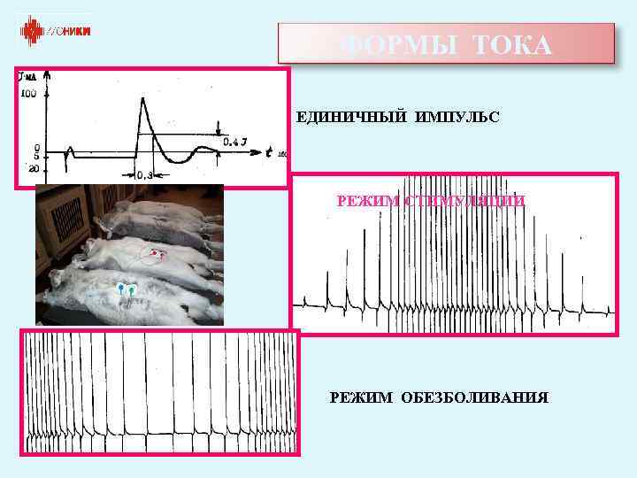 ФОРМЫ ТОКА ЕДИНИЧНЫЙ ИМПУЛЬС РЕЖИМ СТИМУЛЯЦИИ РЕЖИМ ОБЕЗБОЛИВАНИЯ 