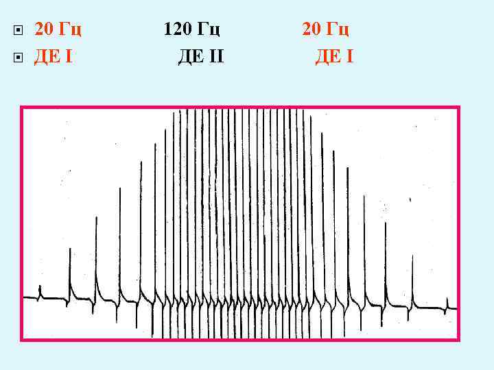  20 Гц 120 Гц 20 Гц ДЕ I ДЕ II ДЕ I 