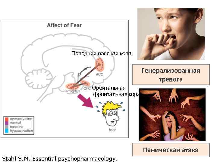 Передняя поясная кора Генерализованная тревога Орбитальная фронтальная кора Паническая атака Stahl S. M. Essential