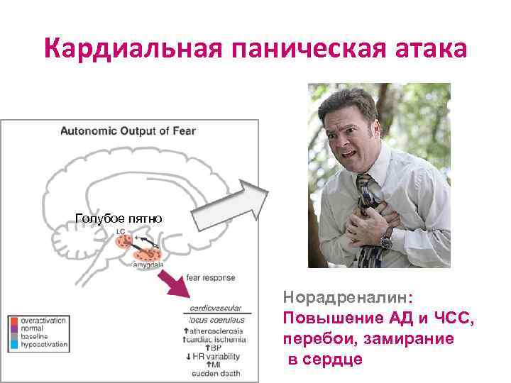 Кардиальная паническая атака Голубое пятно Норадреналин: Повышение АД и ЧСС, перебои, замирание в сердце