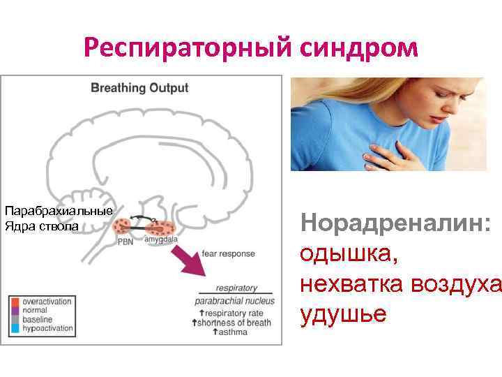 Респираторный синдром Парабрахиальные Ядра ствола Норадреналин: одышка, нехватка воздуха удушье 