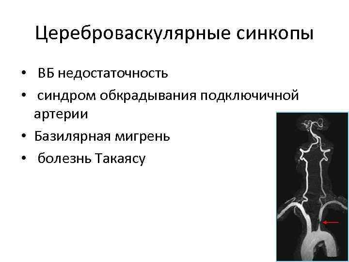 Для болезни такаясу характерно наличие в клинической картине