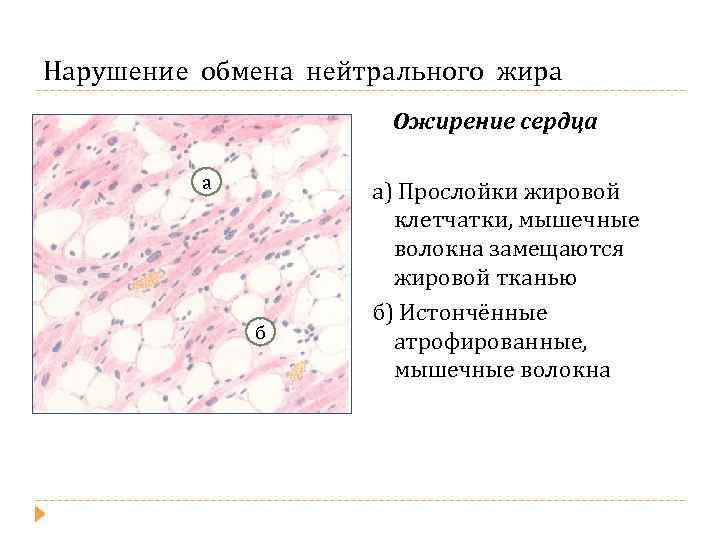 Нарушение жирового обмена патофизиология презентация